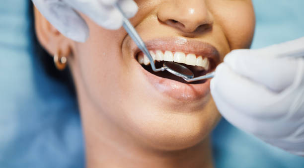 Best Emergency Denture Repair in Itasca, TX